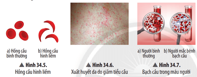 Quan sát các Hình từ 34.5 đến 34.9, hãy kể tên, nêu nguyên nhân và các biện pháp